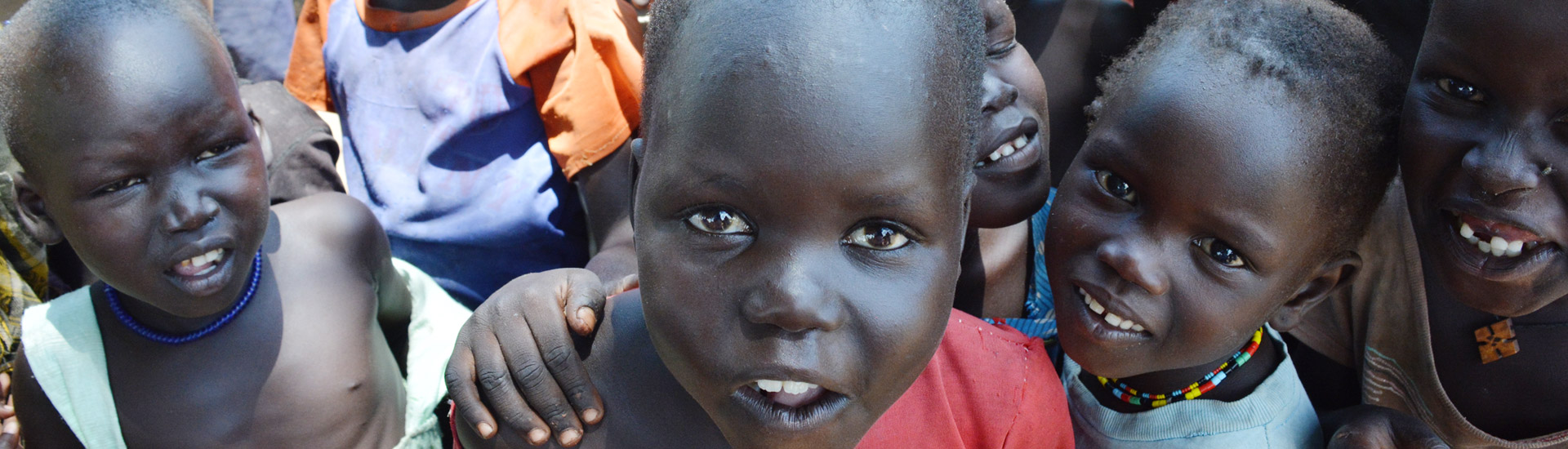 Malnutrición en Gumbo, Sudán del Sur